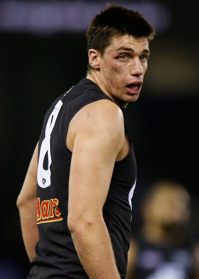 AFL 2015 Rd 18 - Carlton v North Melbourne MELBOURNE, AUSTRALIA - AUGUST 1: Matthew Kreuzer of the Blues is seen with a black eye during the 2015 AFL round 18 match between the Carlton Blues and the North Melbourne Kangaroos at Etihad Stadium, Melbourne, Australia on August 1, 2015. (Photo by Adam Trafford/AFL Media)